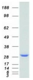 SDS-PAGE (UCHL1-01HFL).jpg